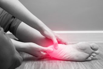 Dolore al tallone e calzature: cosa valutare in presenza di uno sperone calcaneare