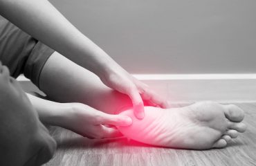33840-sperone-calcaneare