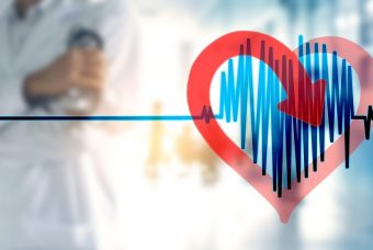 Fibrillazione atriale: al Policlinico Casilino incontro cardiologi e medici di famiglia